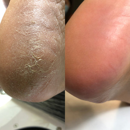 Kératolytique pieds Podologie+ 100ml NAILSOFTHEDAY