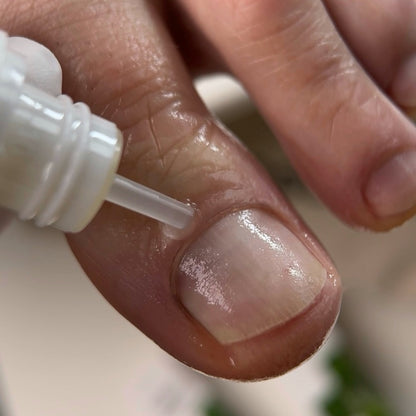 Масло против онихолизиса - Onistopix Resultum